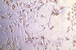 Cell in vitro culture